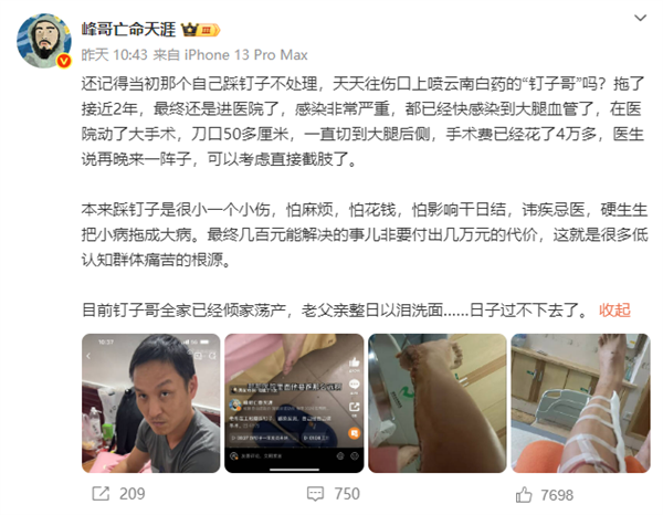 男子2年前踩釘子未就醫 只用自來水洗傷口噴藥：面臨截肢風險！